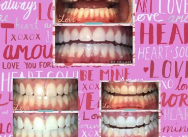 Smile Labs of Houma